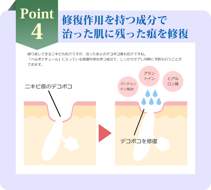 Point4 修復作用を持つ成分で治った肌に残った痕を修復